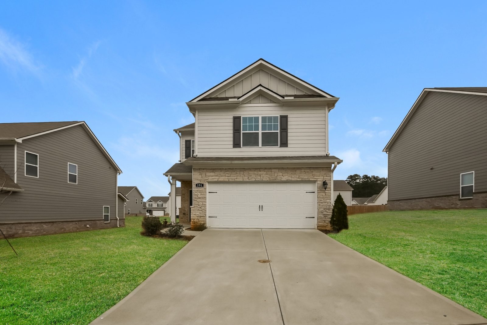 000 photo front view 13571728